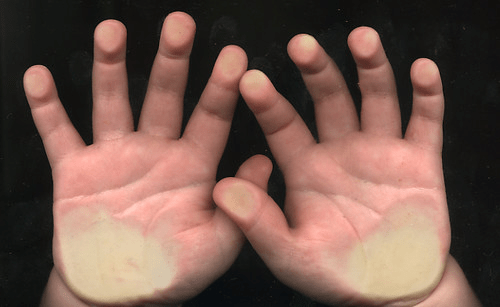 image of child's hands found on creative commons. Image by andrechinn.